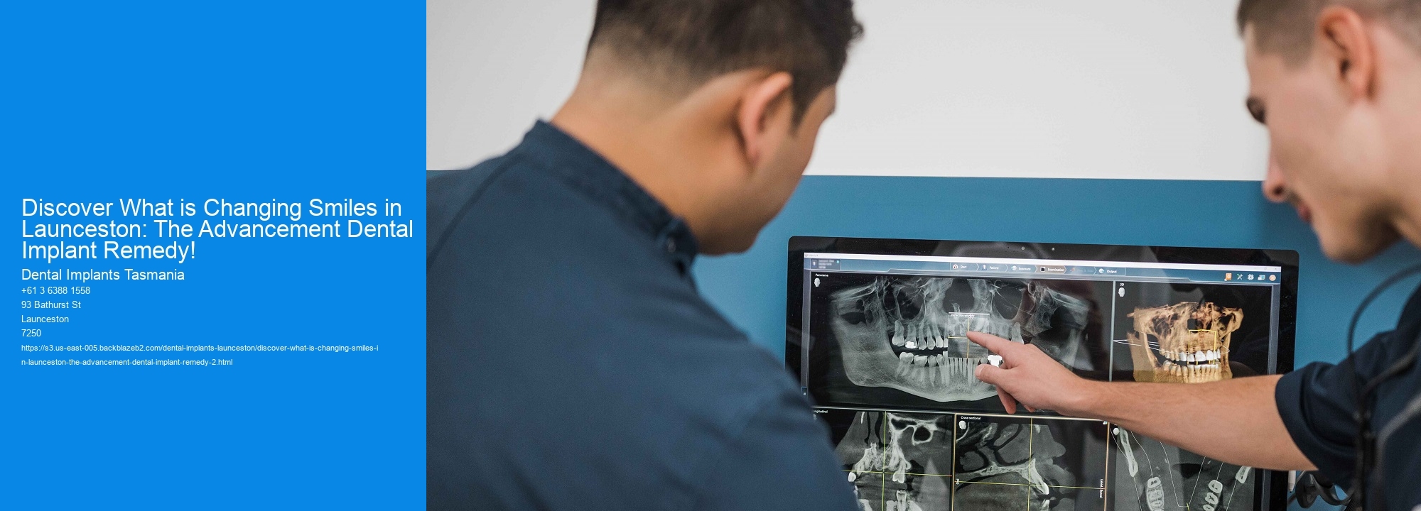 Discover What is Changing Smiles in Launceston: The Advancement Dental Implant Remedy!