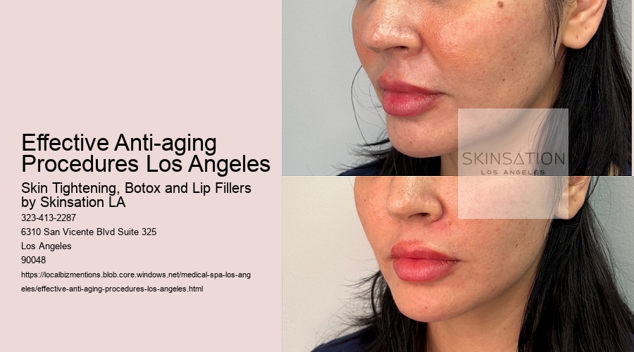 Effective Anti-aging Procedures Los Angeles